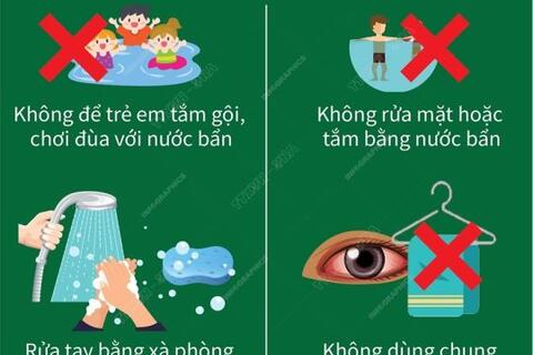 Phòng tránh bệnh về mắt và Bệnh đau mắt đỏ, những điều cần biết